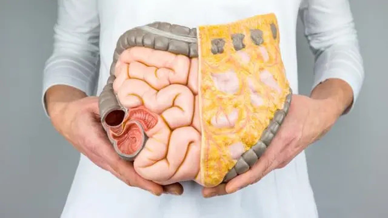 Anak-anak dari salah satu orangtua yang pernah kena kanker usus besar, perlu menjalani kolonoskopi pada usia 40-an.