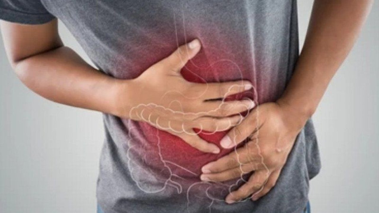Irritable Bowel Syndrome (IBS) adalah gangguan pencernaan kronis yang menyebabkan nyeri perut, perubahan buang air besar, dan kembung;  penanganan meliputi perubahan gaya hidup, diet, dan terapi.