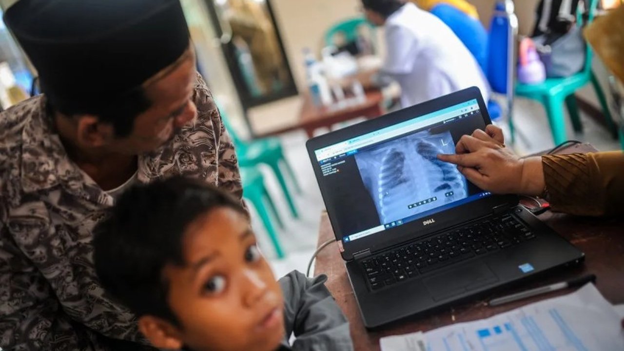 Butuh Vaksin TB Baru? Pakar Sebut BCG Sudah Usang!