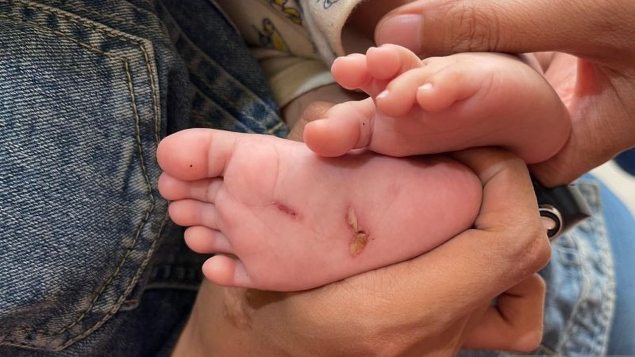 Polresta Mataram telah mengamankan seorang ayah yang menganiaya bayinya yang berusia 2 bulan hingga babak belur di Lombok Barat; pelaku kini dalam pemeriksaan dan berkas perkara tengah dilengkapi.