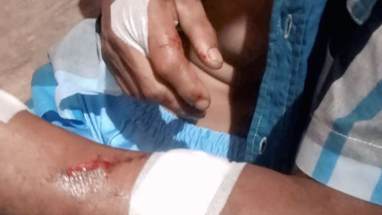 BPBD Tanjungpinang mengimbau warga pesisir untuk waspada terhadap serangan buaya setelah insiden seorang warga diterkam di Sungai Ladi.