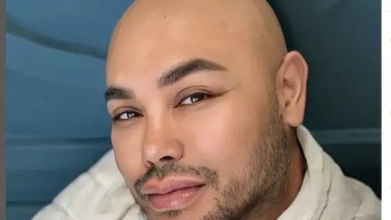 Tuntas Jalankan Ibadah Haji, Ivan Gunawan Kini Tampil dengan Kepala Plontos. (dok.Instagram @ivan_gunawan/https://www.instagram.com/