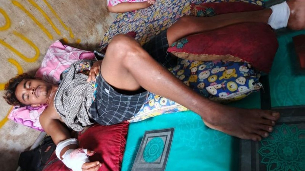 Dua pekerja sawit di Kotim diserang beruang madu. Diduga satwa ini terganggu saat tidur. Bagaimana kronologi lengkap dan langkah BKSDA?