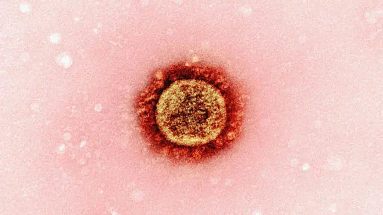 Ilustrasi Cacar Air (Foto: Unsplash/National Institute of Allergy and Infectious Diseases)