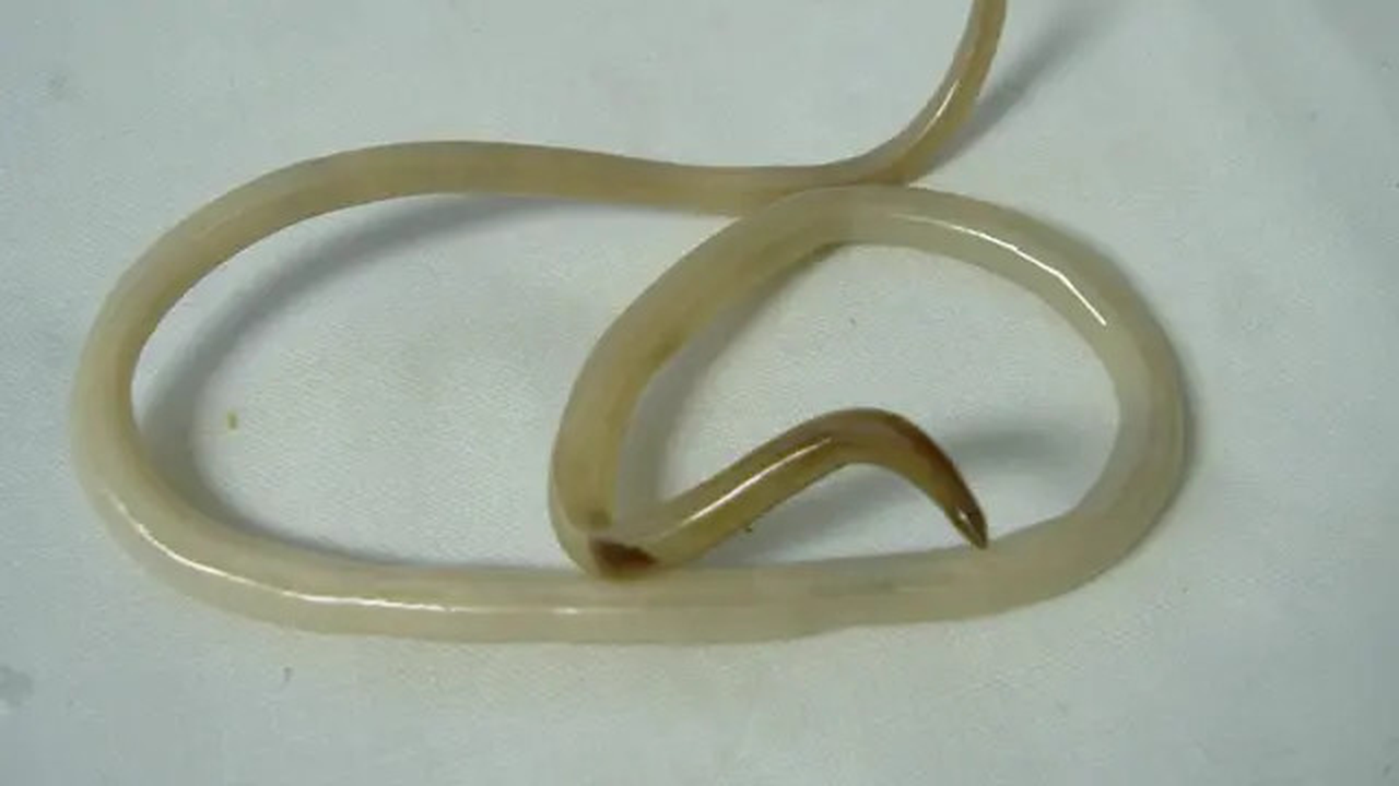 Cacing gelang bisa sebabkan anak kurang gizi, sementara cacing cambuk mampu hisap darah.