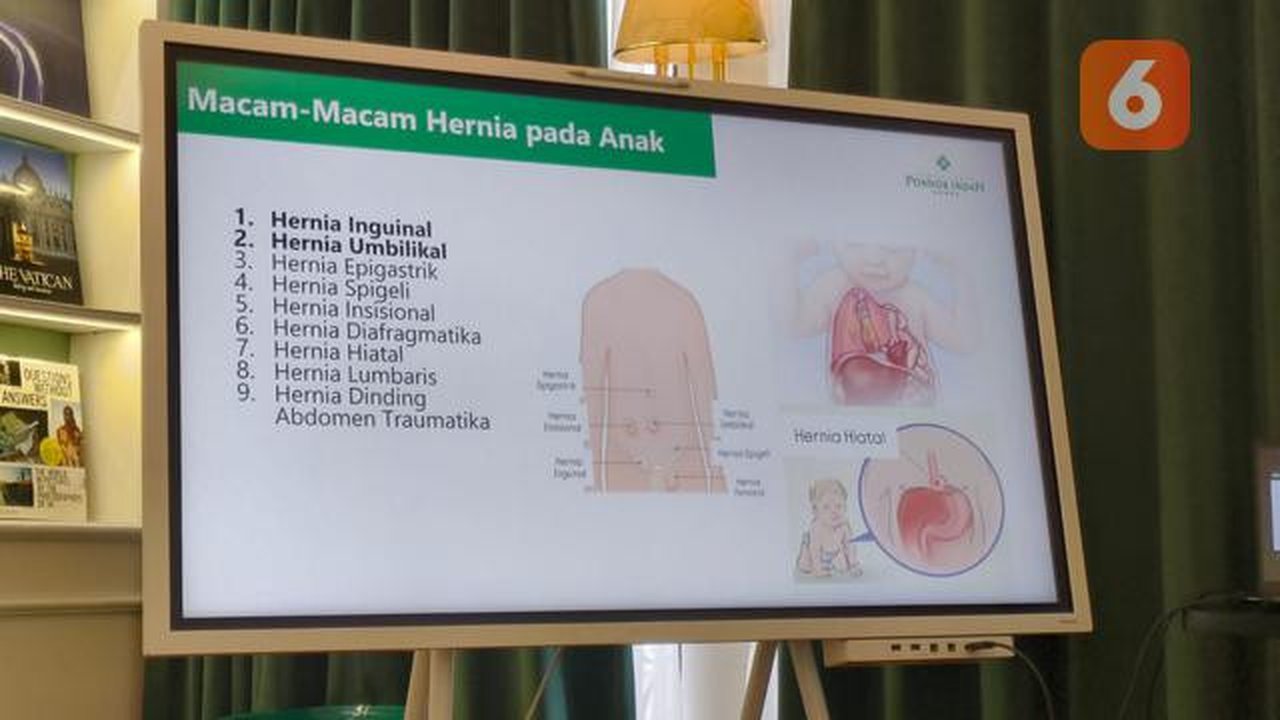 Ada Benjolan Hilang Timbul di Pusar Anak, Waspada Gejala Hernia. Foto: Liputan6.com/Ade Nasihudin.