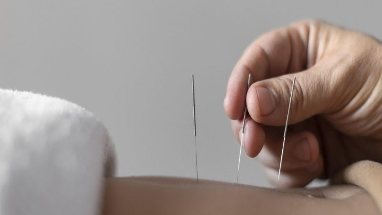 Dokter spesialis akupunktur medik menyebut akupuntur wajah sebagai solusi aman untuk kulit tampak lebih cerah dan segar, didukung produksi kolagen alami dan mikrosirkulasi darah optimal.