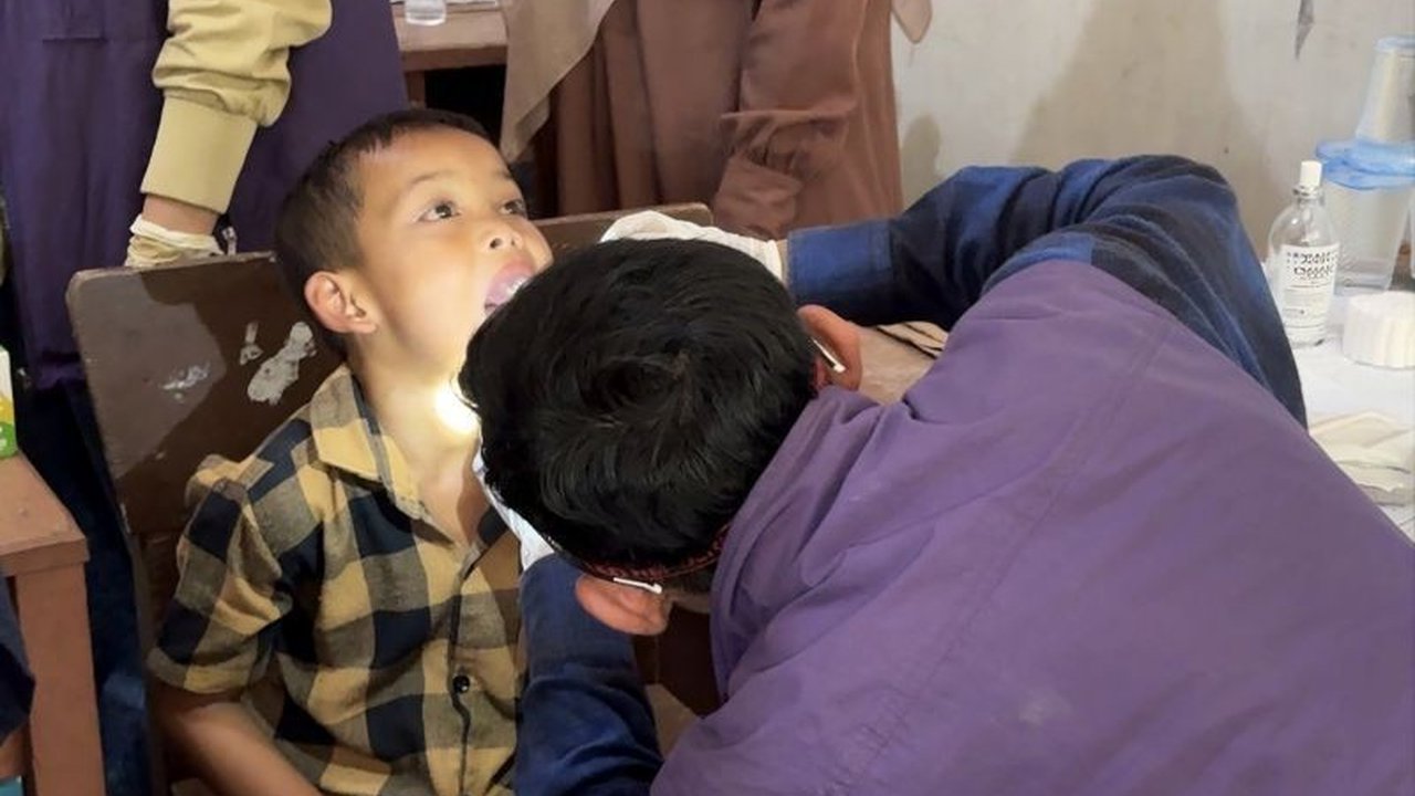 Persatuan Dokter Gigi Indonesia (PDGI) memberikan layanan kesehatan gigi gratis di Gayo Lues pascabencana, fokus pada anak-anak yang terdampak untuk mengatasi akses terbatas.