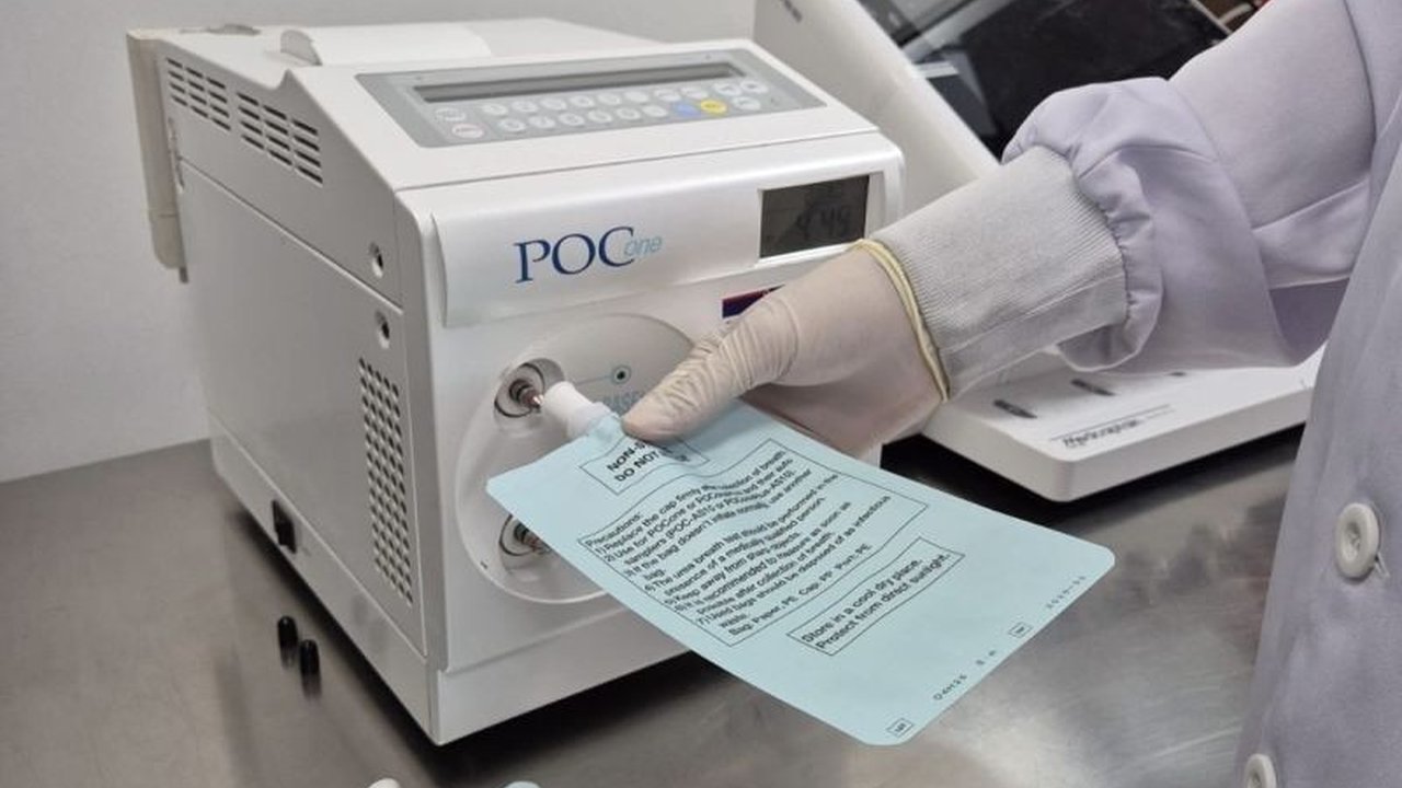 Dokter spesialis menyebut Urea Breath Test (UBT) sebagai pilihan utama deteksi H.pylori, bakteri penyebab berbagai masalah lambung hingga kanker, berkat sensitivitas dan spesifisitasnya yang tinggi.