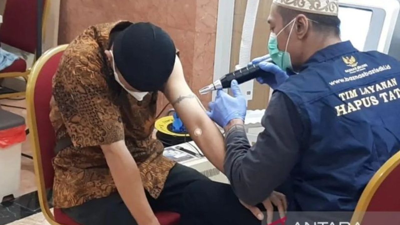Baznas DKI Jakarta kembali membuka pendaftaran Layanan Hapus Tato Gratis selama Ramadhan 1447 H, menargetkan 1.000 peserta. Jangan lewatkan kesempatan berhijrah dan memperbaiki diri!