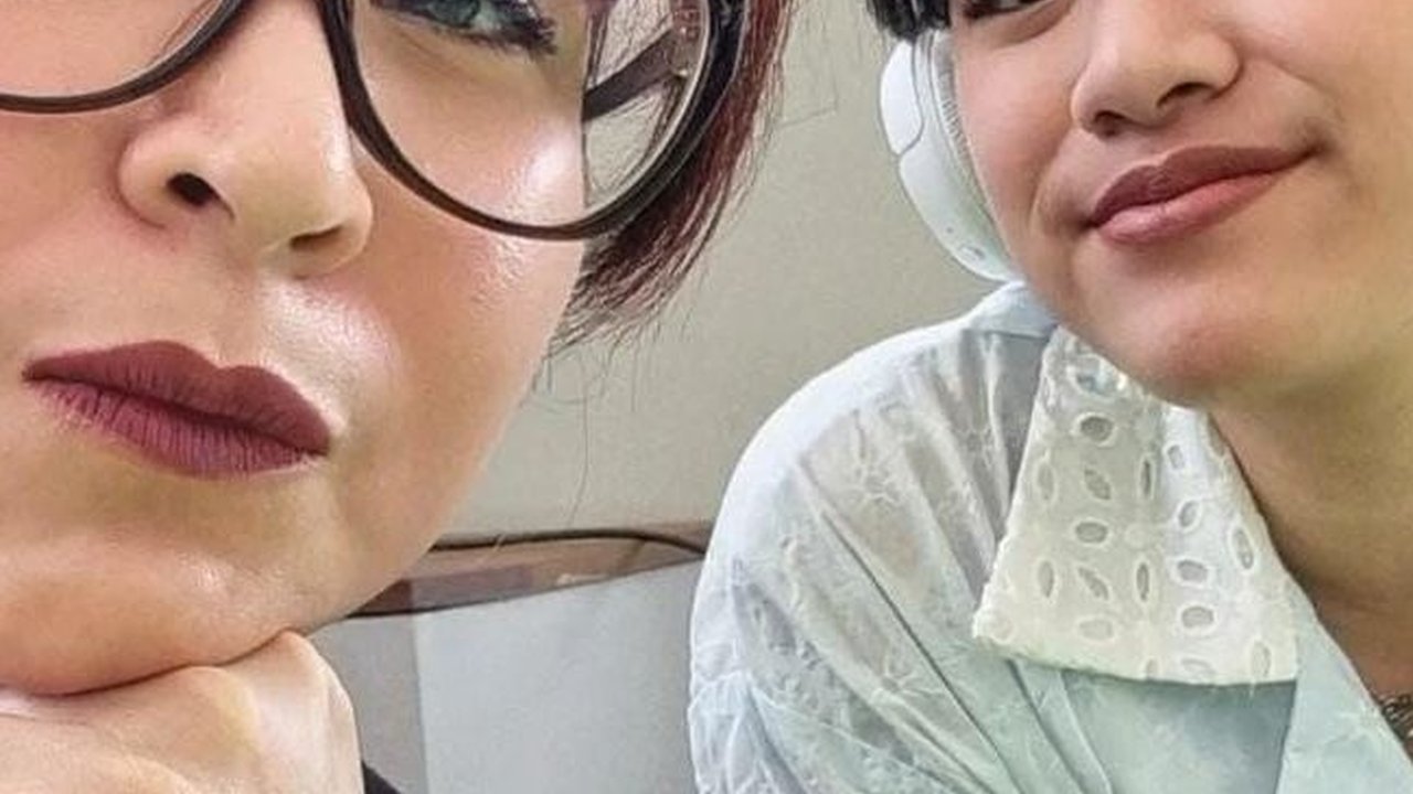 Putri Cantik Novita Angie Jatuh di Eskalator dan Dilarikan ke RS, Begini Kondisinya