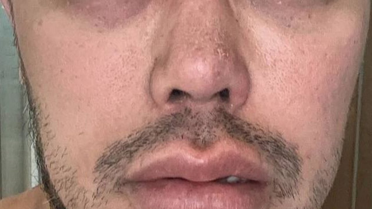 Ivan Gunawan Mengaku 'Berantem' Hingga Mata Bengkak dan Alami Sesak Nafas