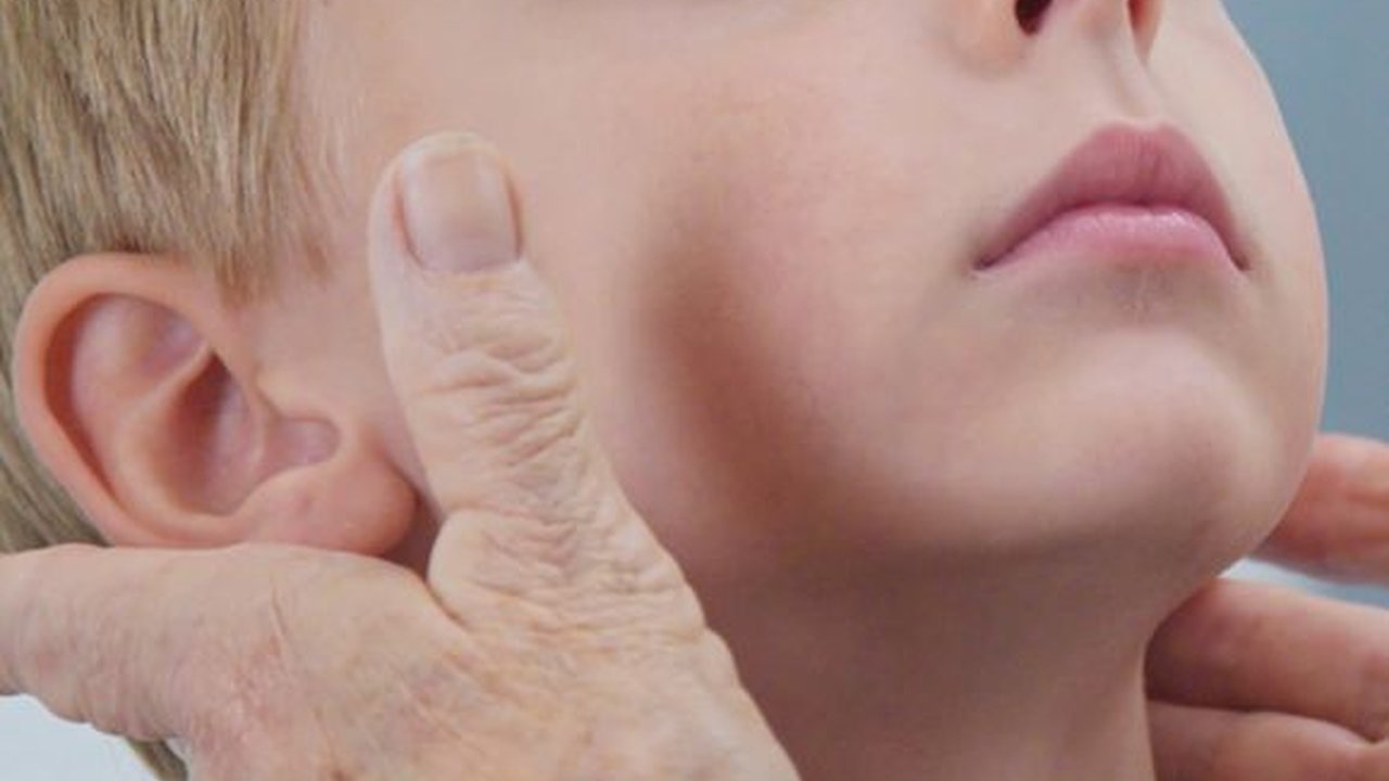 Kenali Gejala Limfoma pada Anak dan Penyebabnya, Orang Tua Wajib Tahu