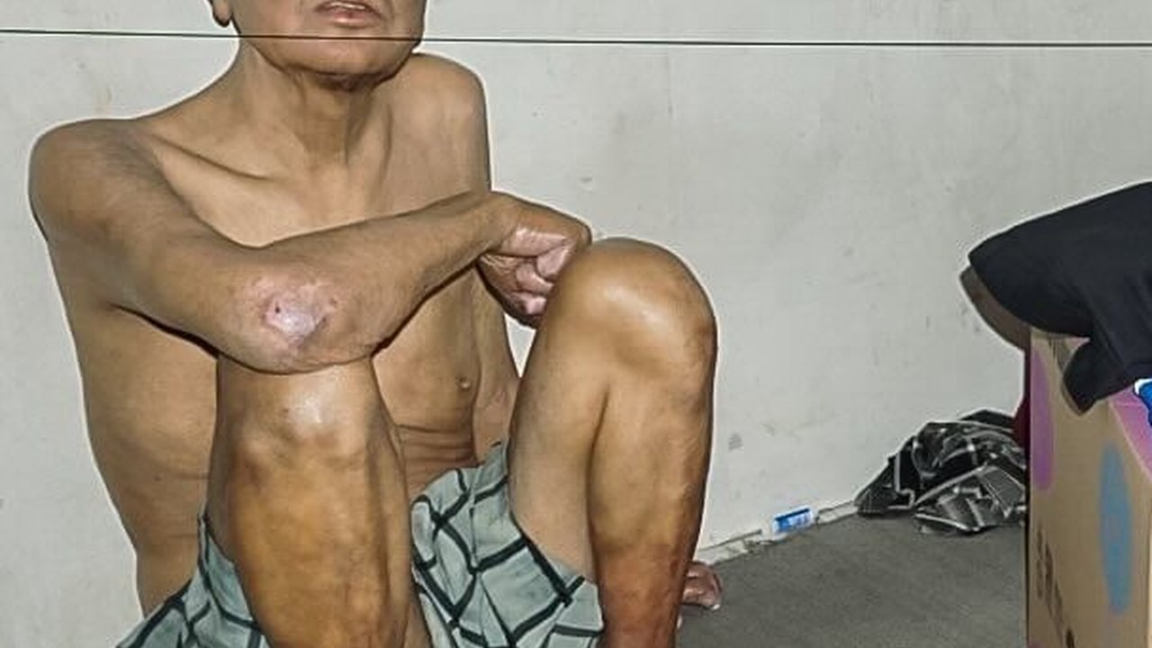 Mantan Pemain PSIS Semarang Ini Kini Hidup Memprihatinkan, Sakit Diabetes hingga Tinggal di Rusun