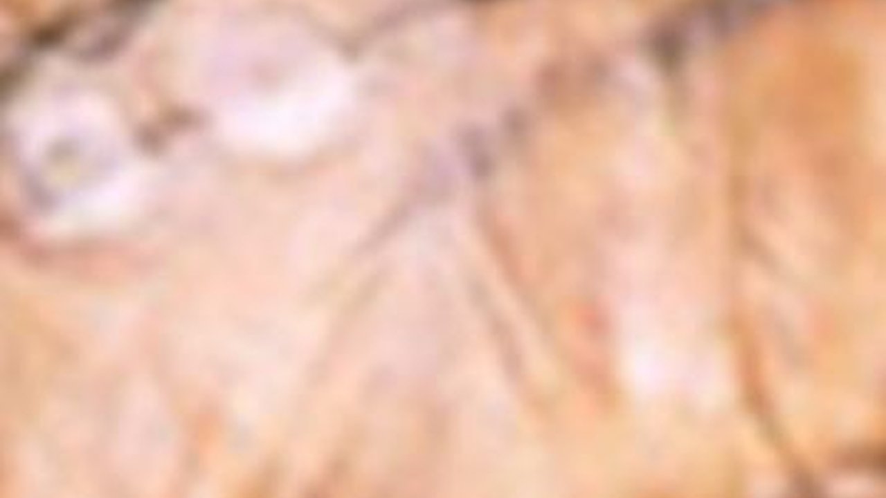 Kasus Cacar Monyet di Indonesia Meningkat, Kenali Gejala dan Upaya Pencegahannya