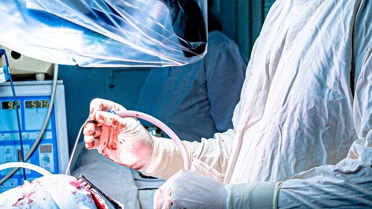 Operasi Amandel adalah Tindakan Medis Pengangkatan Amandel, Ketahui Risikonya