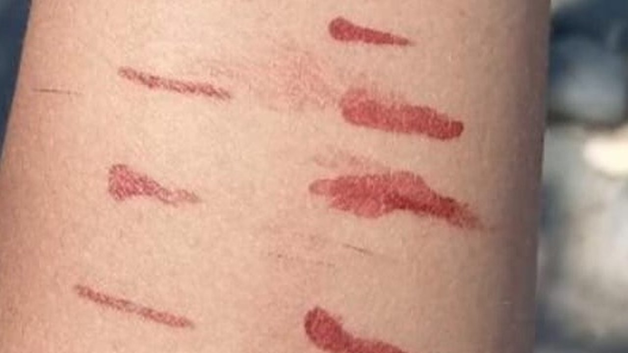 Ikuti Tren TikTok, 11 Siswa SD di Situbondo Sayat Tangan Sendiri