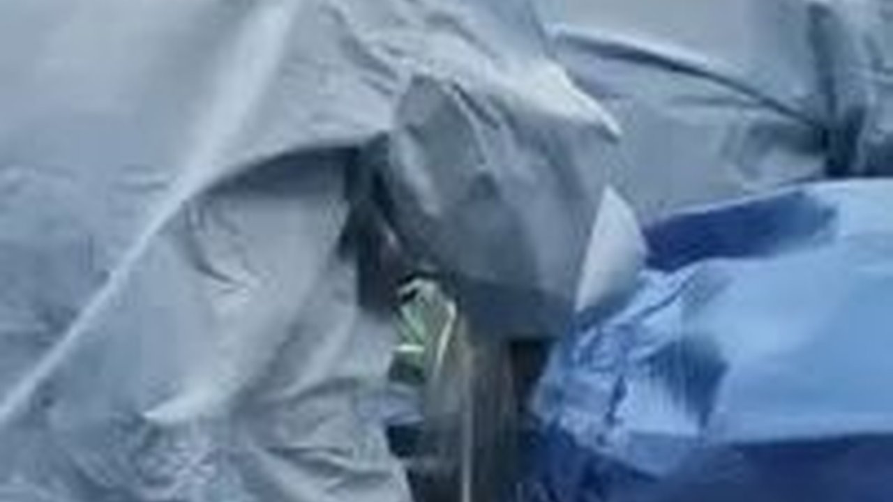 Mengenal TAVI, Bedah Modern Penggantian Katup Jantung