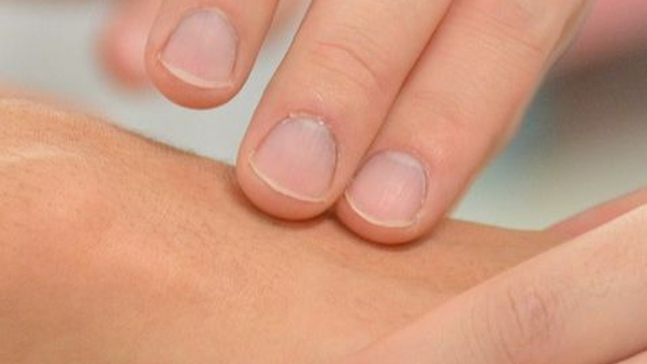 Cara Mencegah Herpes Zoster, Vaksinasi hingga Terapkan Kebiasaan Bersih