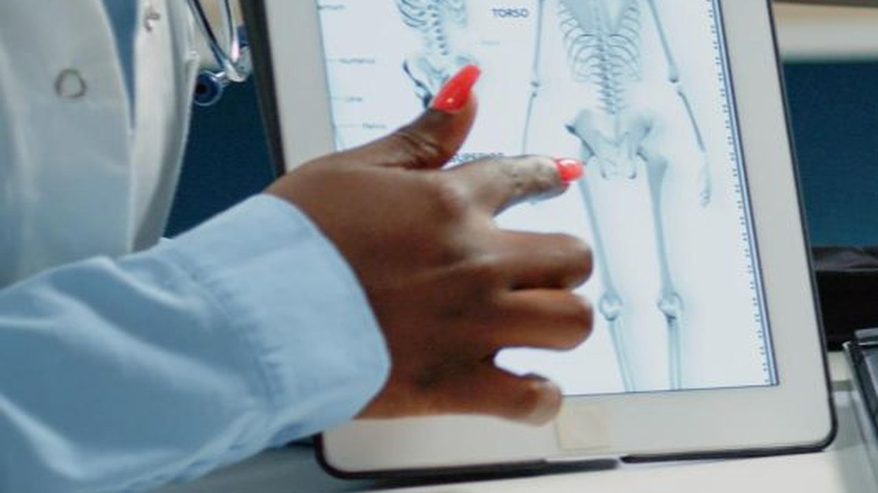 Cara Mencegah Osteoporosis Sejak Usia Muda, Jangan Tunda Nanti