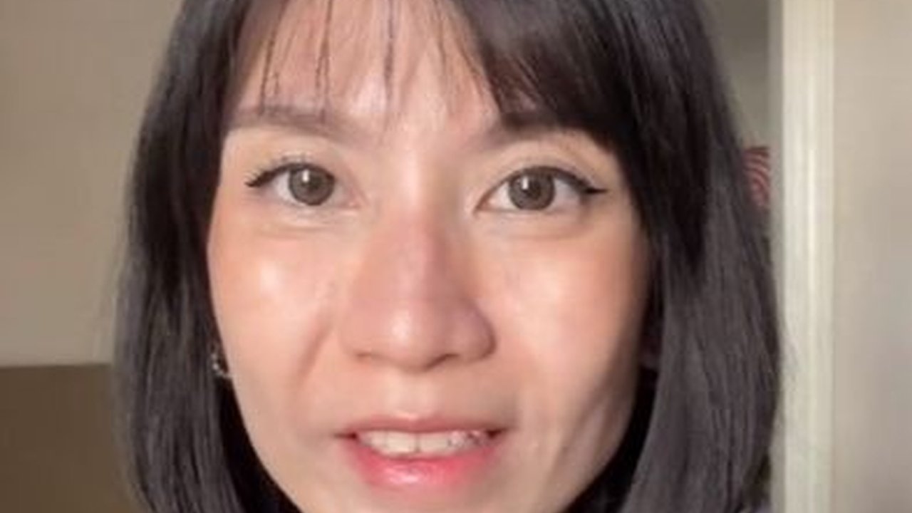 Viral Curhatan Wanita yang Gagal Suntik Botox, Bikin Tak Bisa Tertawa selama Empat Bulan