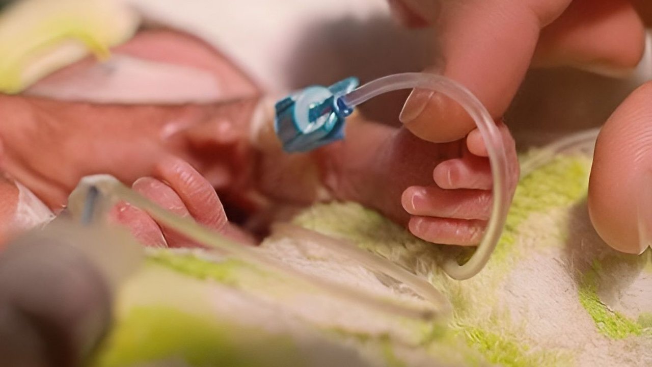 Bayi Prematur di Tasikmalaya Meninggal Usai Dijadikan Konten, Begini Penjelasan Dokter Anak