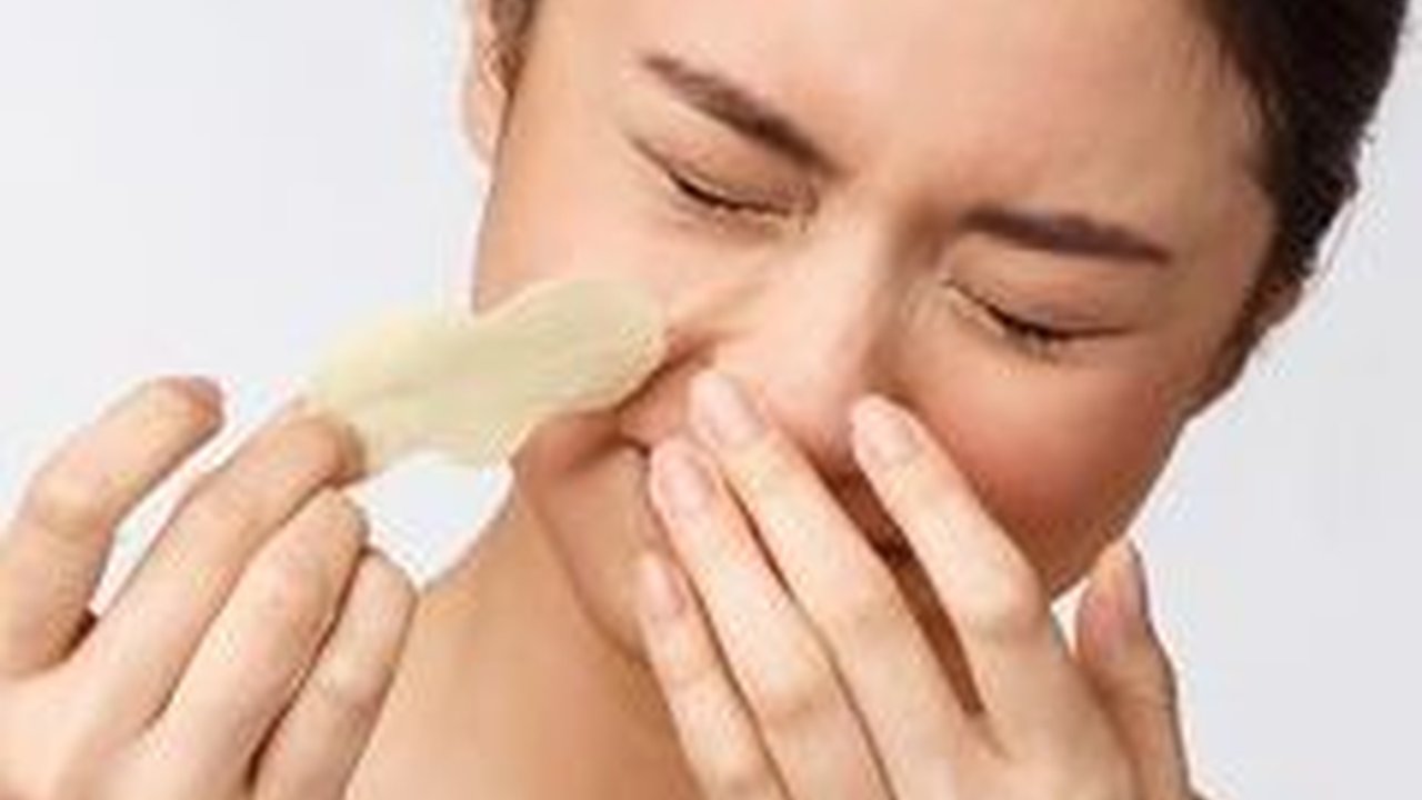 Beda Komedo Putih dan Komedo Hitam, Penyebab, Jenis, dan Cara Mengatasinya