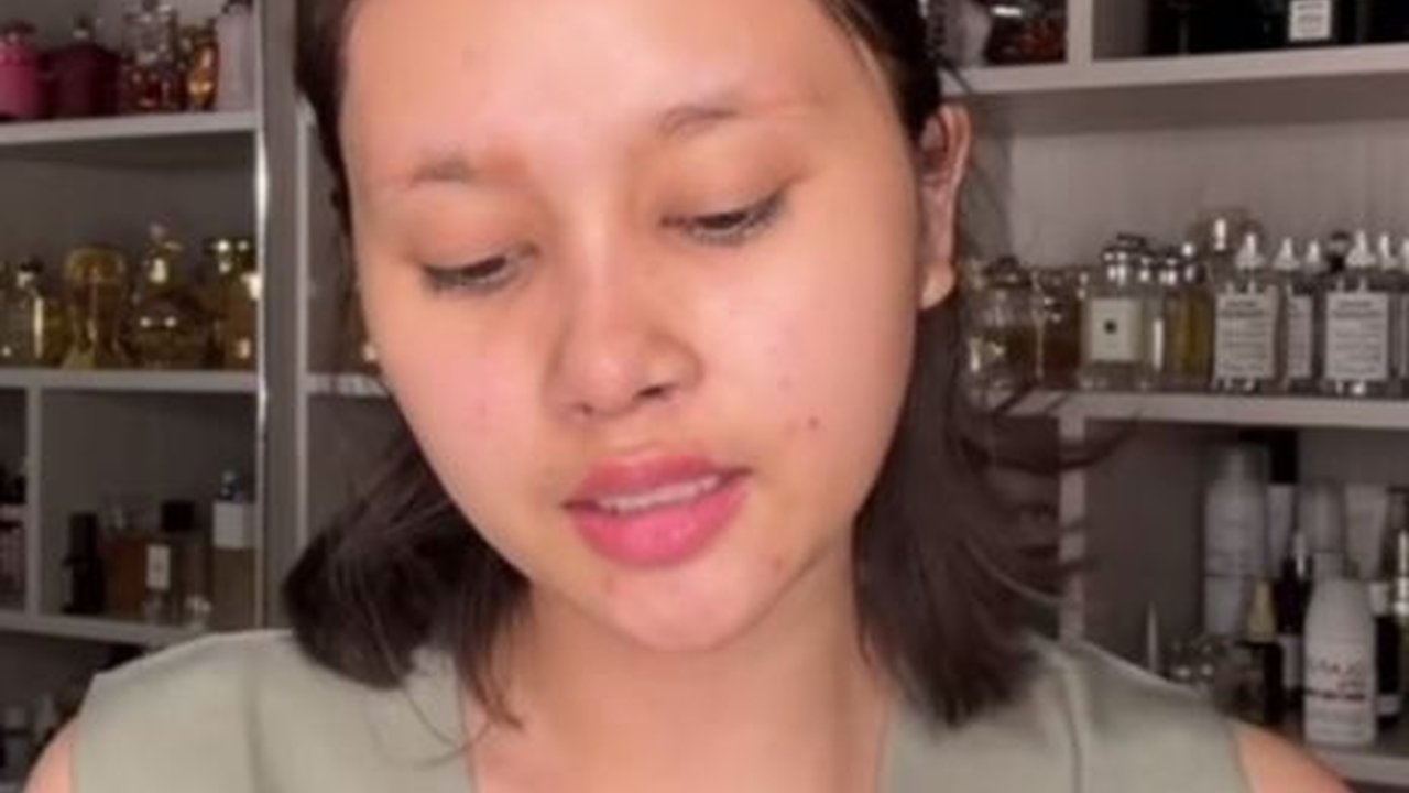 Kembali Lakukan Oplas Lagi, Ini Potret Baru Permesta Dhyaz yang Disebut Lebih Cantik Dulu