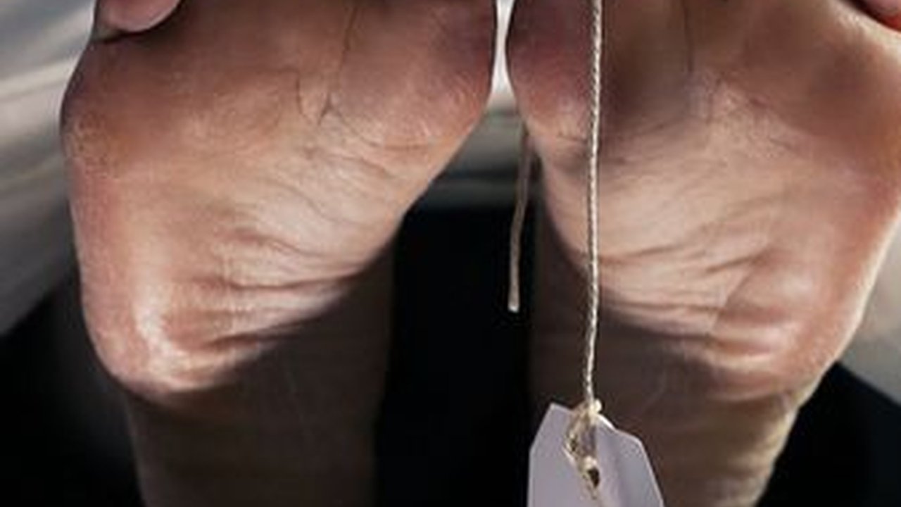 7 Fakta Terbaru Penemuan 5 Mayat Tanpa Identitas di UNPRI Medan, Diduga Cadaver