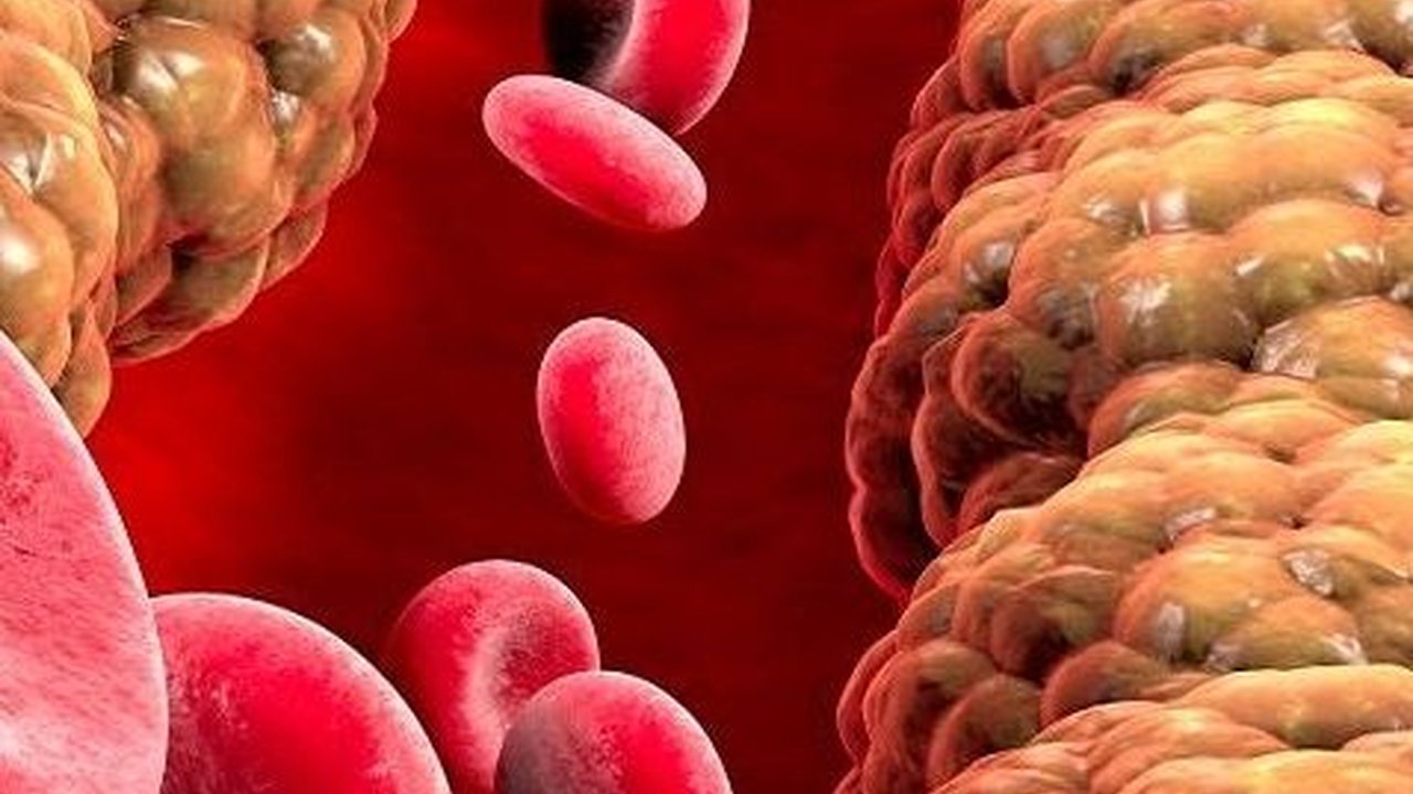 Bahaya Kolesterol Tinggi yang Harus Diwaspadai, Ketahui Cara Menjaganya agar Tetap Normal