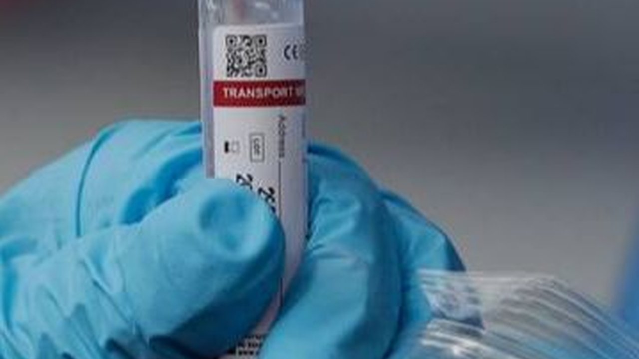 43 Kasus Covid-19 Ditemukan di Bali, Warga Diimbau Terapkan Prokes