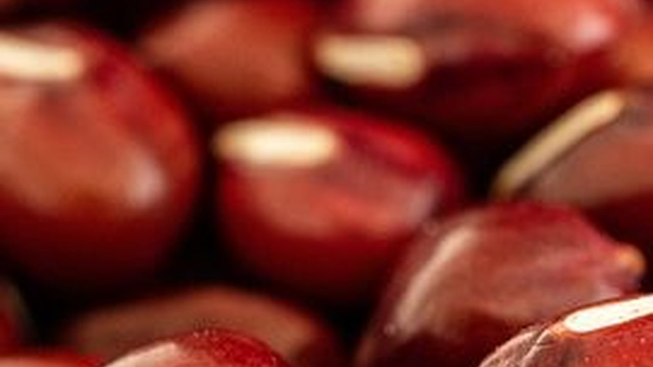 Ciri-Ciri Batu Ginjal yang Perlu Diwaspadai, Ketahui Pencegahannya