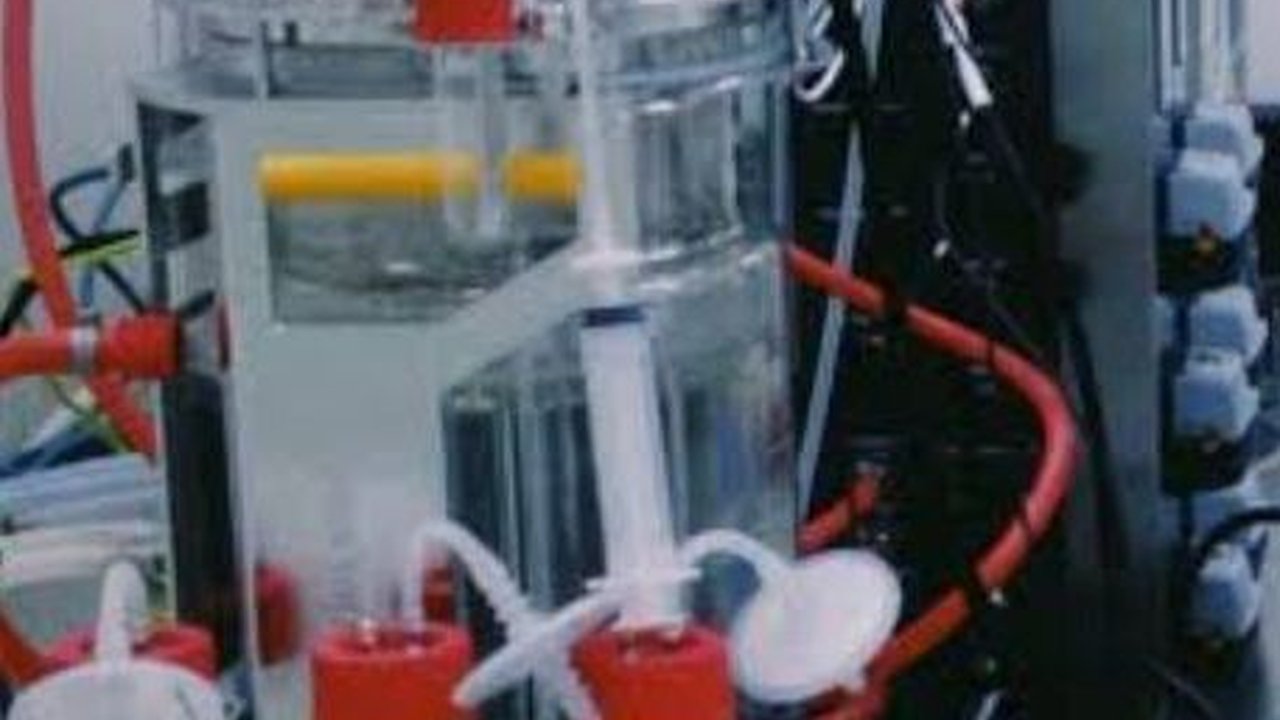Terapi Autologus Stem Cell Dinilai Bisa Sembuhkan Pasien Parkinson