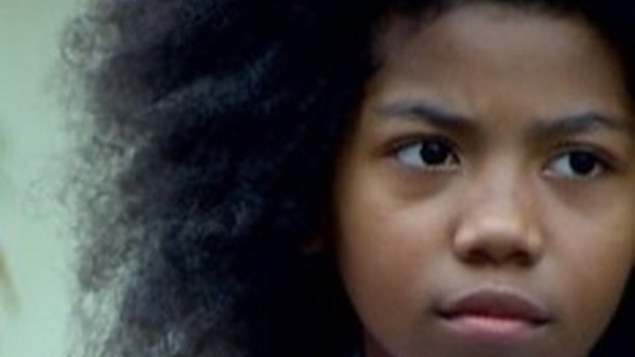 Masih Ingat dengan Pemeran Si Cemong? Kini Potretnya Bak Artis Hollywood Usai Diduga Jalani Oplas, Bikin Pangling