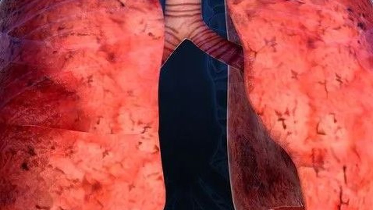 Perbedaan Paru-paru Perokok dan Bukan Perokok, Ketahui Ciri-cirinya