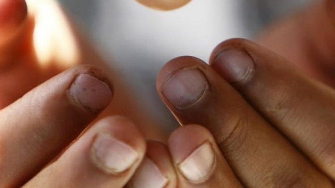 Niat Puasa Qadha di Bulan Dzulhijjah, Bisa Dibarengi dengan Puasa Sunah Lainnya