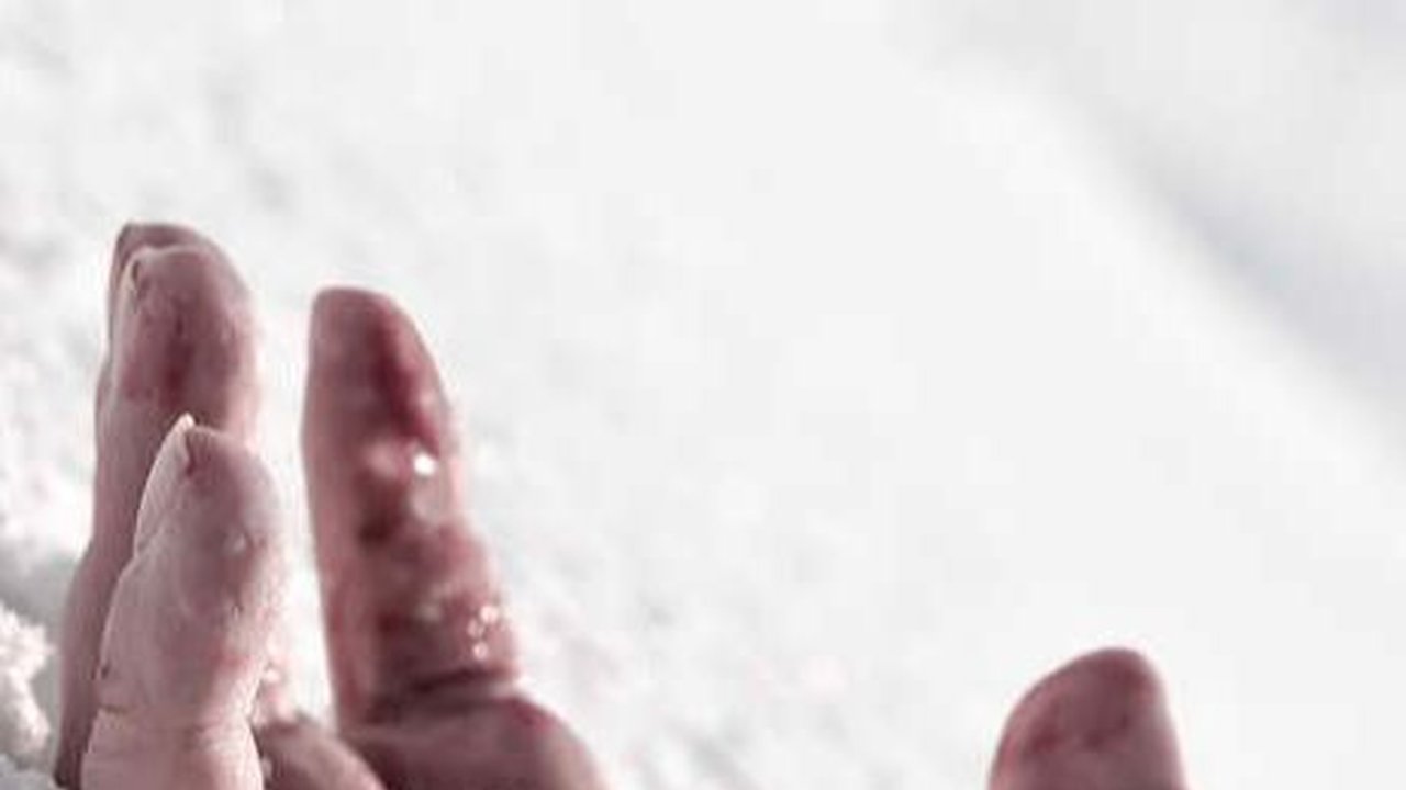 Mengenal Frostbite: Gejala, Tahap, dan Penyebabnya