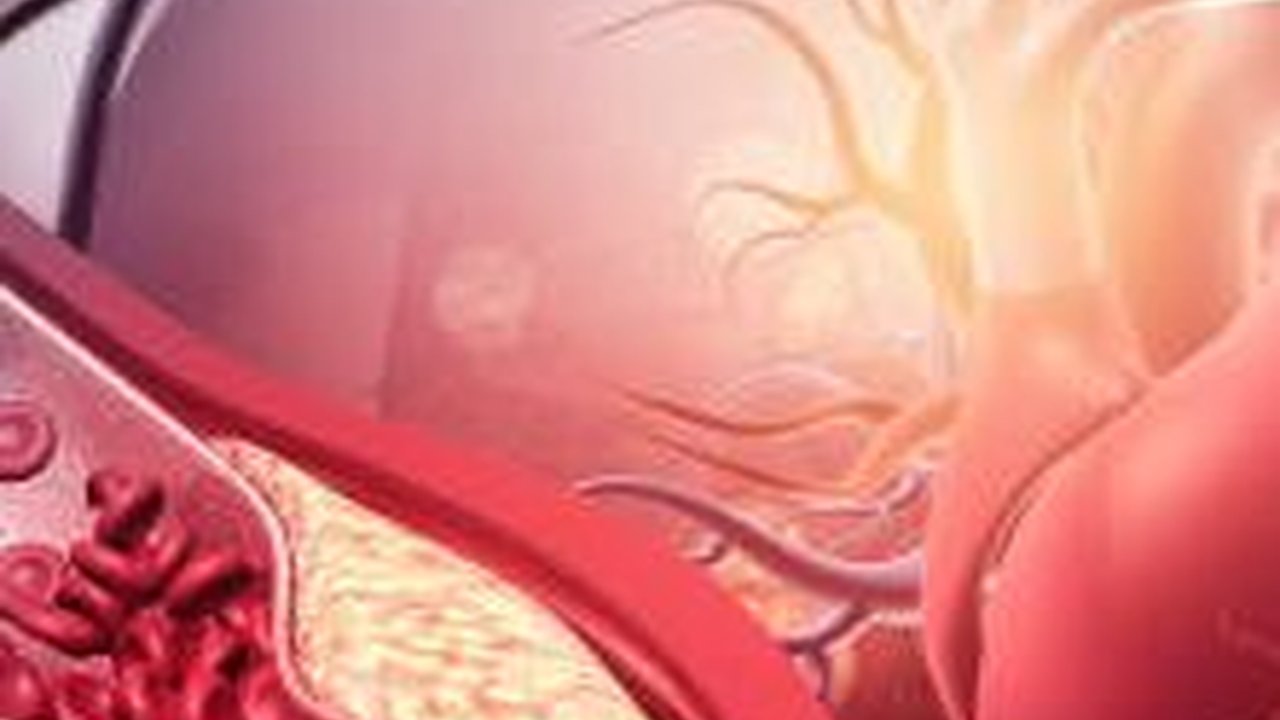 Cara Cepat Menurunkan Kolesterol secara Alami, Lakukan dengan Rutin