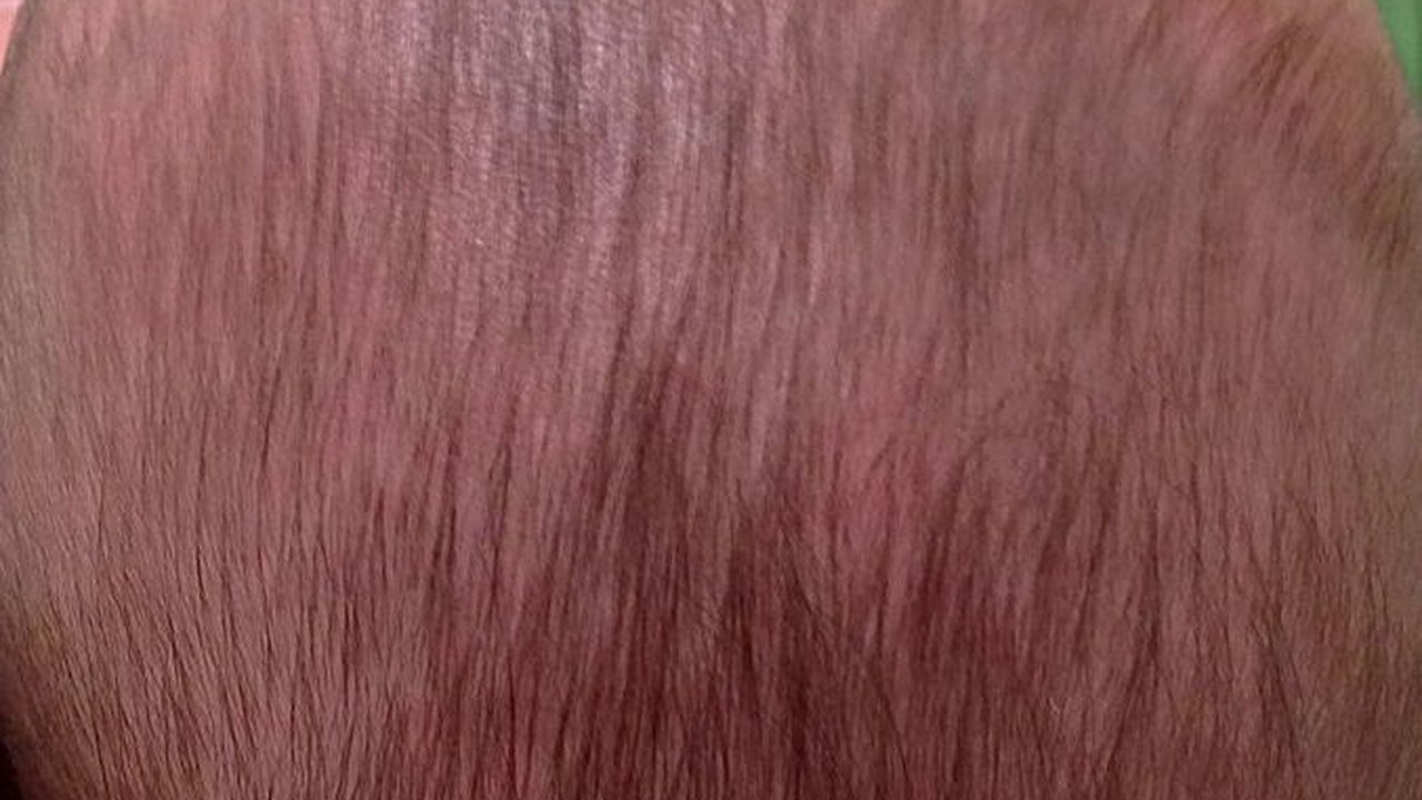 Kepala Peyang pada Bayi Bisa Dicegah Sejak Kehamilan, Ketahui Faktor Penyebabnya