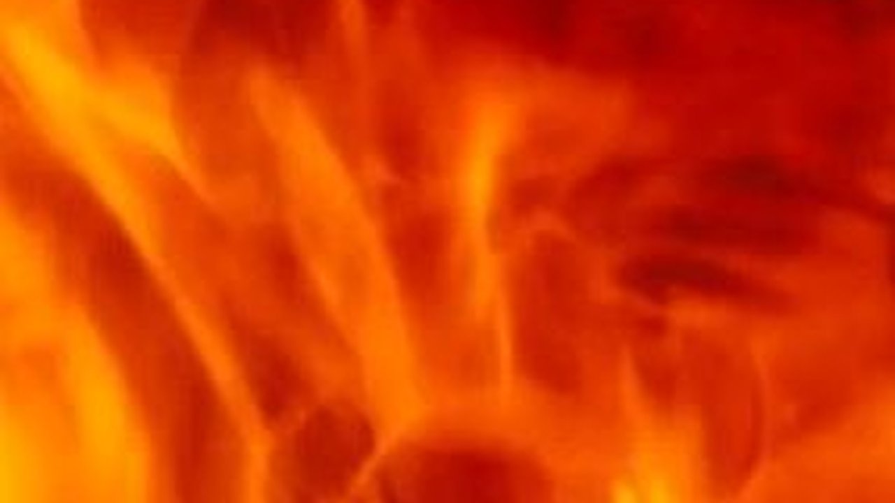 Bocah 8 Tahun di Semarang Alami Luka Bakar Parah, Diduga Dibakar Teman Sendiri