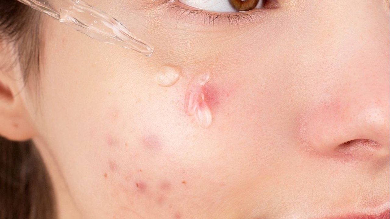 6 Jenis Serum untuk Tiap Masalah Kulit dan Kandungan Penting yang Harus Ada di Dalamnya