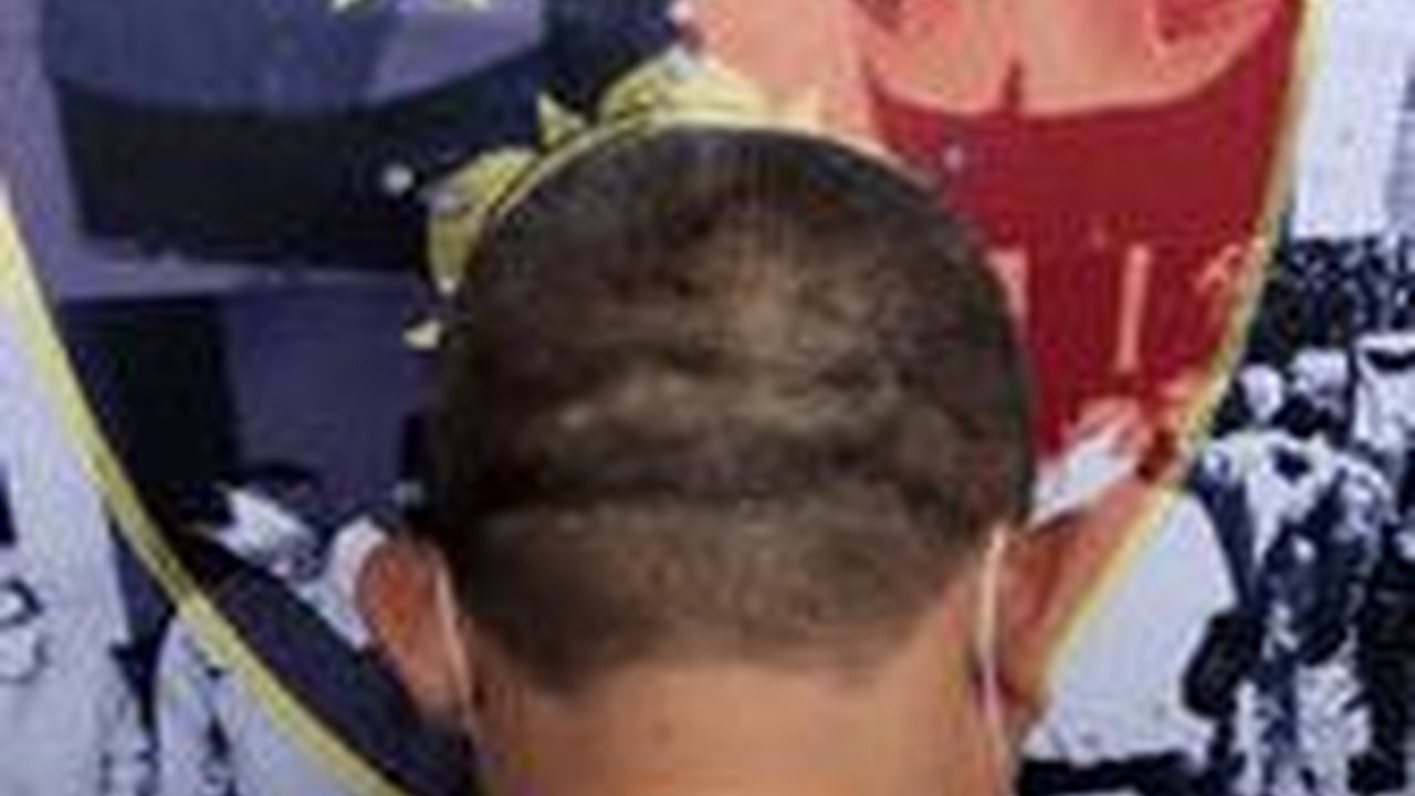 Fakta Baru Kasus TPPO Jual Beli Ginjal: Korban Direkrut Lewat FB hingga Imigrasi Terlibat