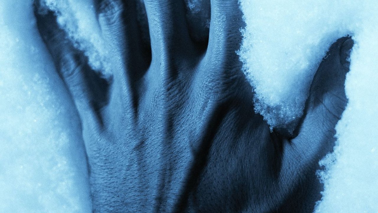 Komplikasi Hipotermia dan Tanda-tandanya, Jangan Disepelekan