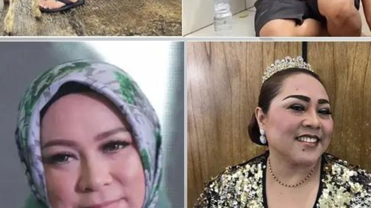 6 Potret Artis Sebelum dan Sesudah Sakit Diabetes, Penampilannya jadi Berbeda