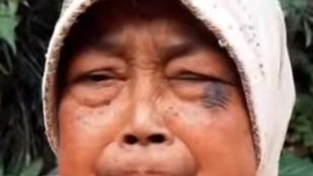 Sesak Dada Melihatnya, Saking Miskinnya Nenek ini Makan Nasi Cuma Sama Micin Dicampur Air Hangat