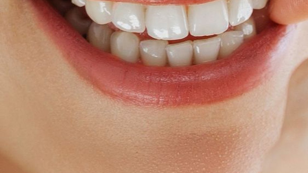 Ups, Deretan Makanan dan Minuman Ini Ternyata Penyebab Kerusakan pada Gigi!