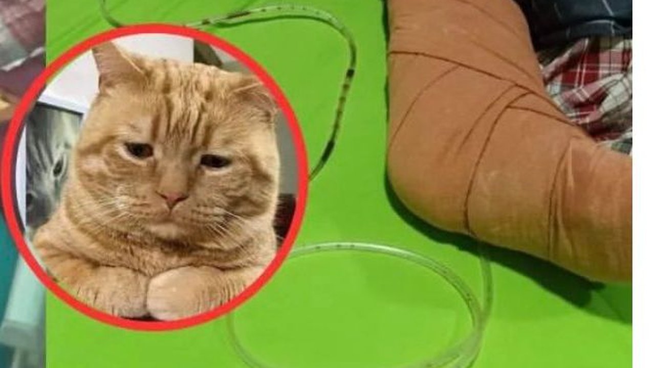 Kisah Viral Bocah Nabila Febrianti, Kaki Diamputasi Gara-Gara Selamatkan Kucing dari Kecelakaan