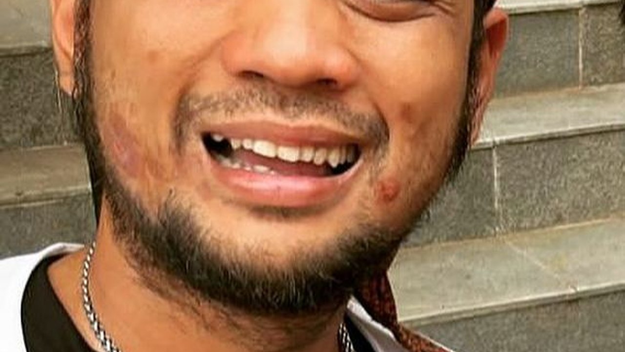 Makin Kurus, Ini Potret Transformasi Panji Petualang yang Kini Mengidap Diabetes