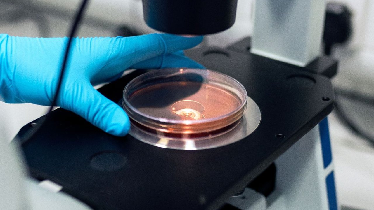 Penyebab Penyakit Autoimun dan Gejala Umumnya yang Penting Diketahui