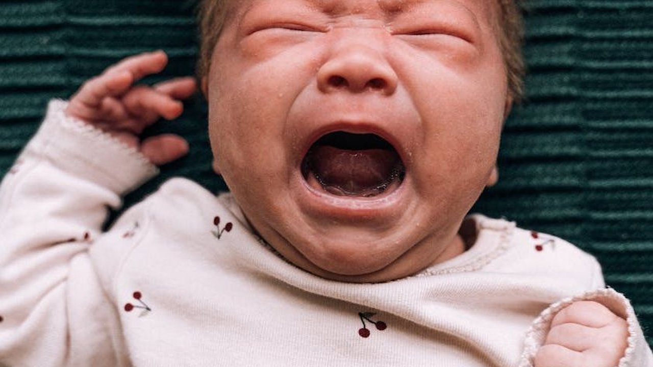 Viral Bayi Dikerokin Sampai Merah, Meski Pakai Bawang, Berbahayakah? Ini Kata Pakar